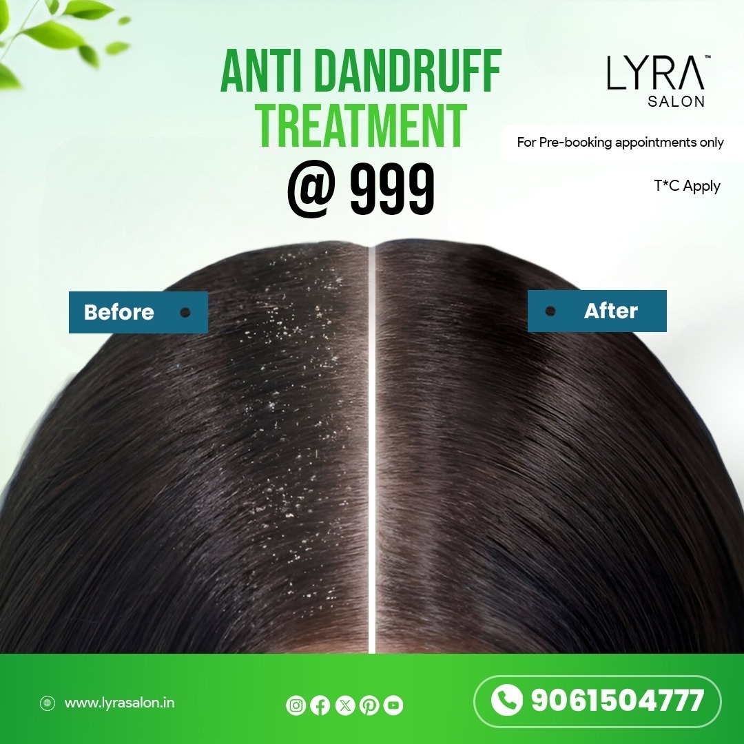 Anti Dandruff Treatment for ₹999 at Lyra Salon